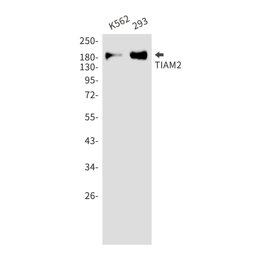 TIAM2 Rabbit Monoclonal Antibody
