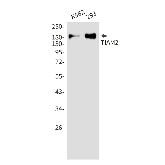 TIAM2 Rabbit Monoclonal Antibody