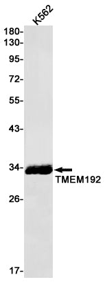 Transmembrane Protein 192 Rabbit Monoclonal Antibody