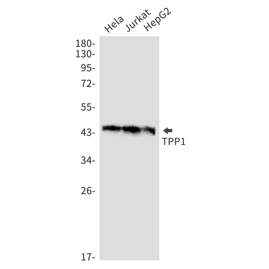 TPP1 Rabbit Monoclonal Antibody