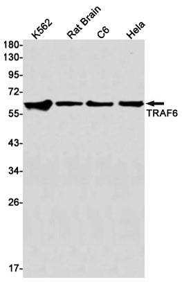 TRAF6 Rabbit Monoclonal Antibody