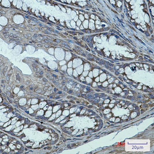 Transglutaminase 2 Rabbit Monoclonal Antibody