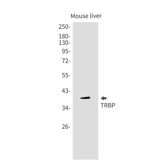 TARBP2 Rabbit Monoclonal Antibody