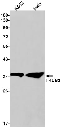 TRUB2 Rabbit Monoclonal Antibody