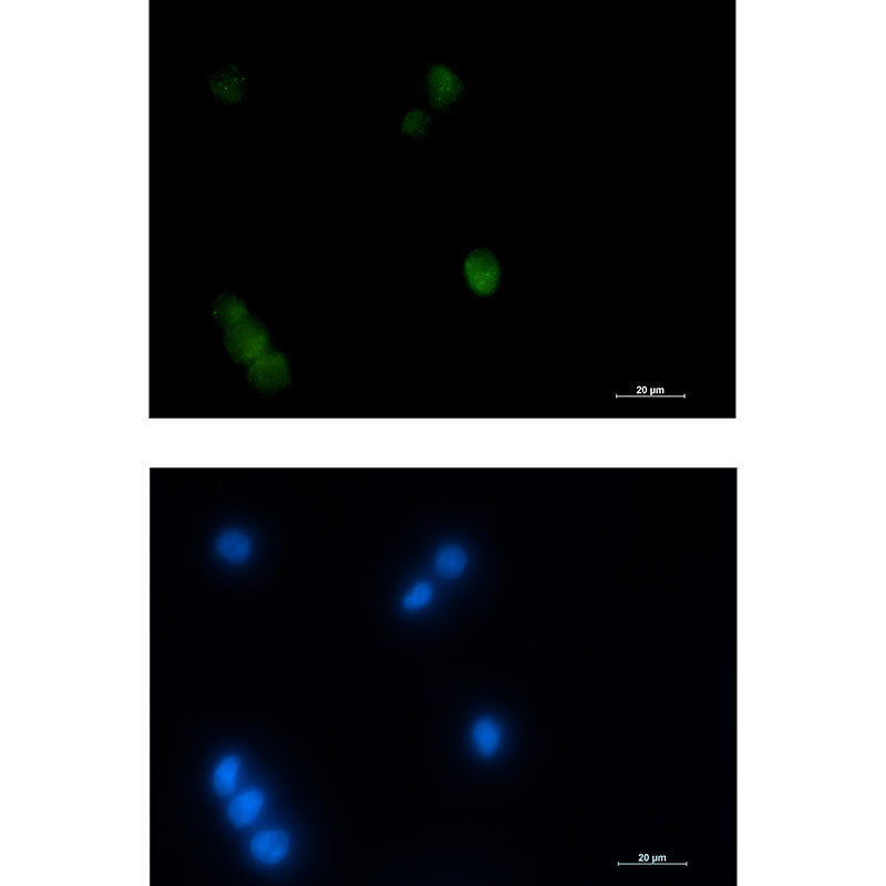 Thyroid Transcription Factor 1 Rabbit Monoclonal Antibody
