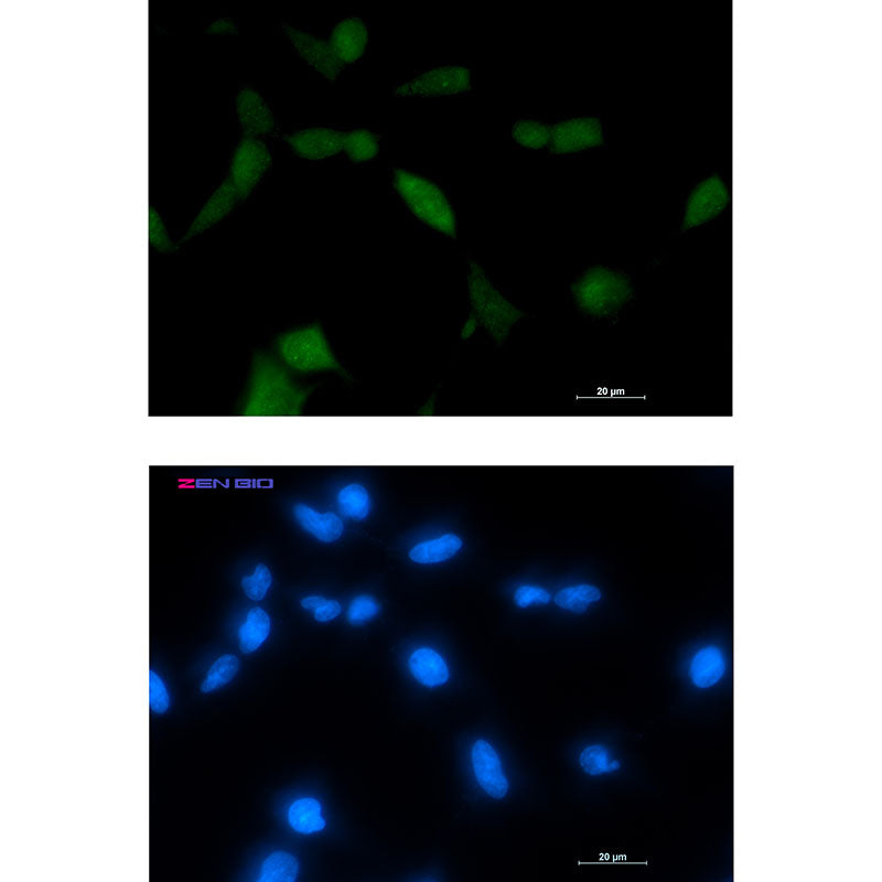 TPPP Rabbit Monoclonal Antibody