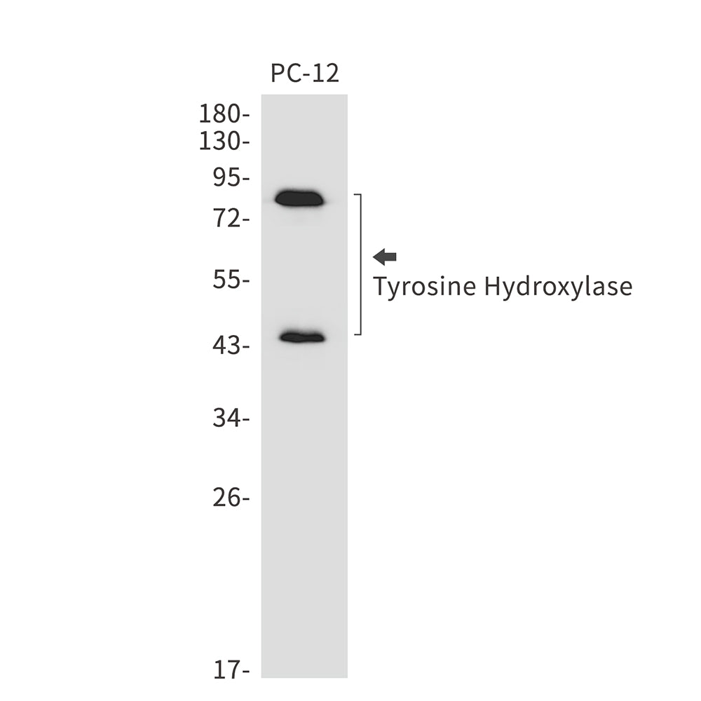 Tyrosine Hydroxylase Rabbit Monoclonal Antibody