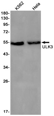 ULK3 Rabbit Monoclonal Antibody