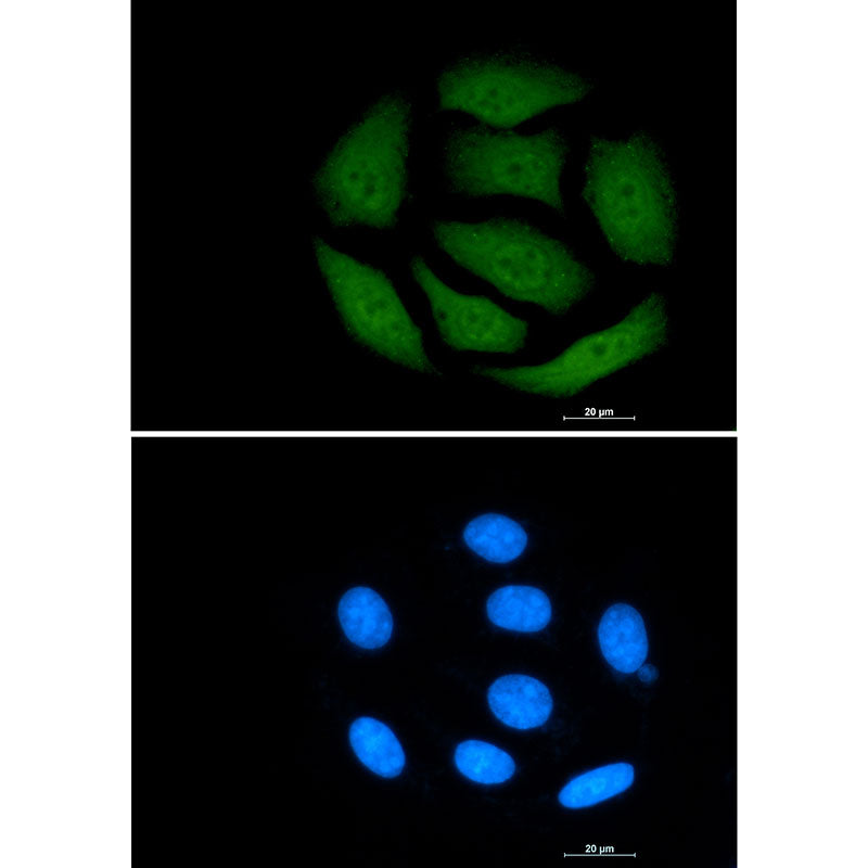 VCP Rabbit Monoclonal Antibody