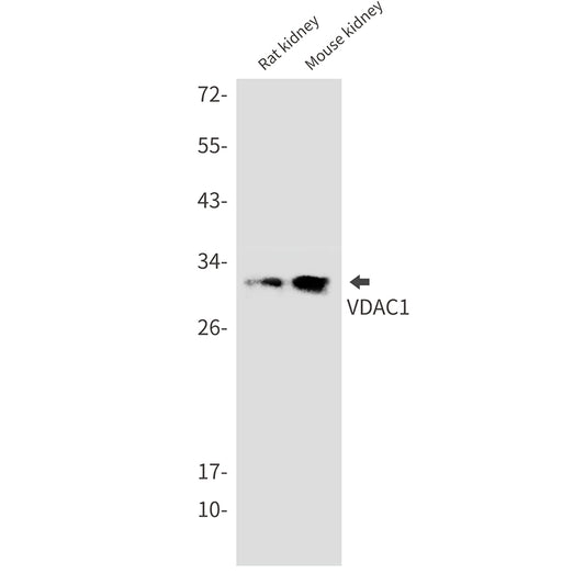 VDAC1 Rabbit Monoclonal Antibody