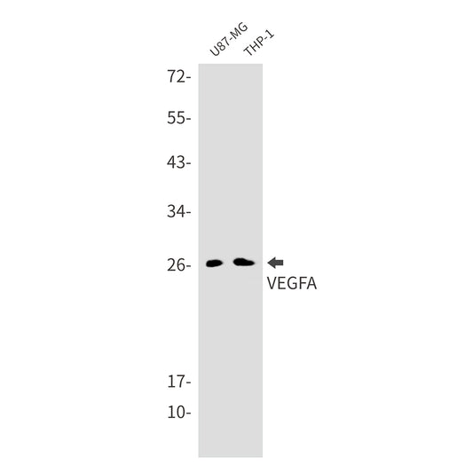 VEGFA Rabbit Monoclonal Antibody