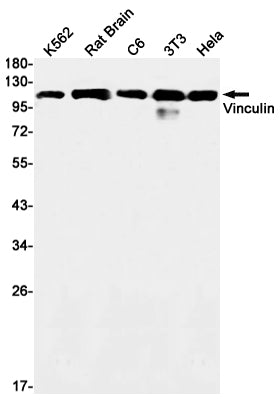 Vinculin Rabbit Monoclonal Antibody