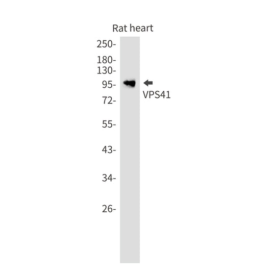 VPS41 Rabbit Monoclonal Antibody