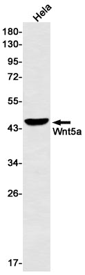 Wnt5a Rabbit Monoclonal Antibody