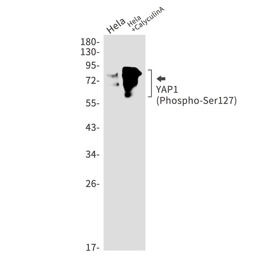 Phospho-YAP1 (Ser127) Rabbit Monoclonal Antibody