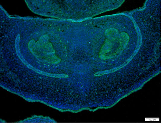 YAP1 Rabbit Monoclonal Antibody