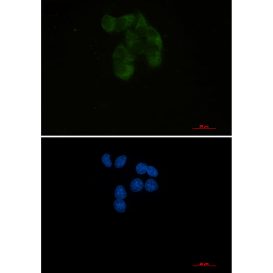 YB1 Rabbit Monoclonal Antibody