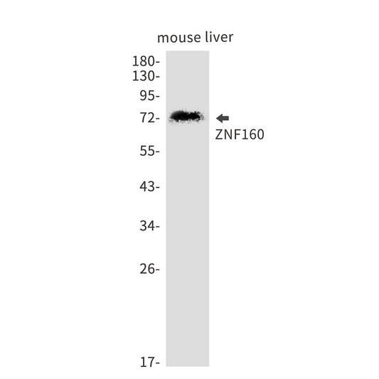ZNF160 Rabbit Monoclonal Antibody