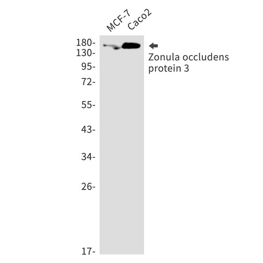 Tight Junction Protein ZO 3 Rabbit Monoclonal Antibody