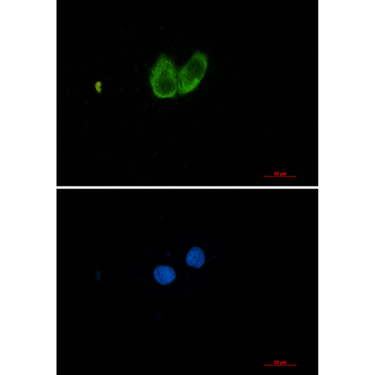 ZYX Rabbit Monoclonal Antibody