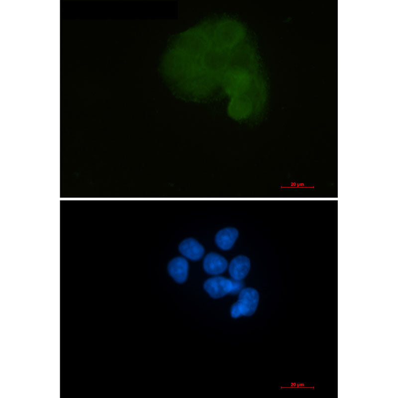 MEK1 Rabbit Monoclonal Antibody