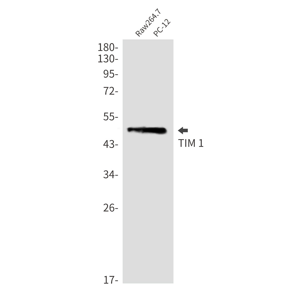 TIM 1 Rabbit Monoclonal Antibody