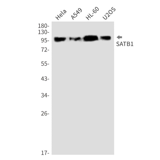 SATB1 Rabbit Monoclonal Antibody