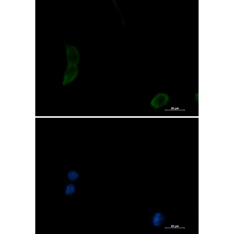PAK1 Rabbit Monoclonal Antibody