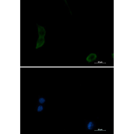 PAK1 Rabbit Monoclonal Antibody