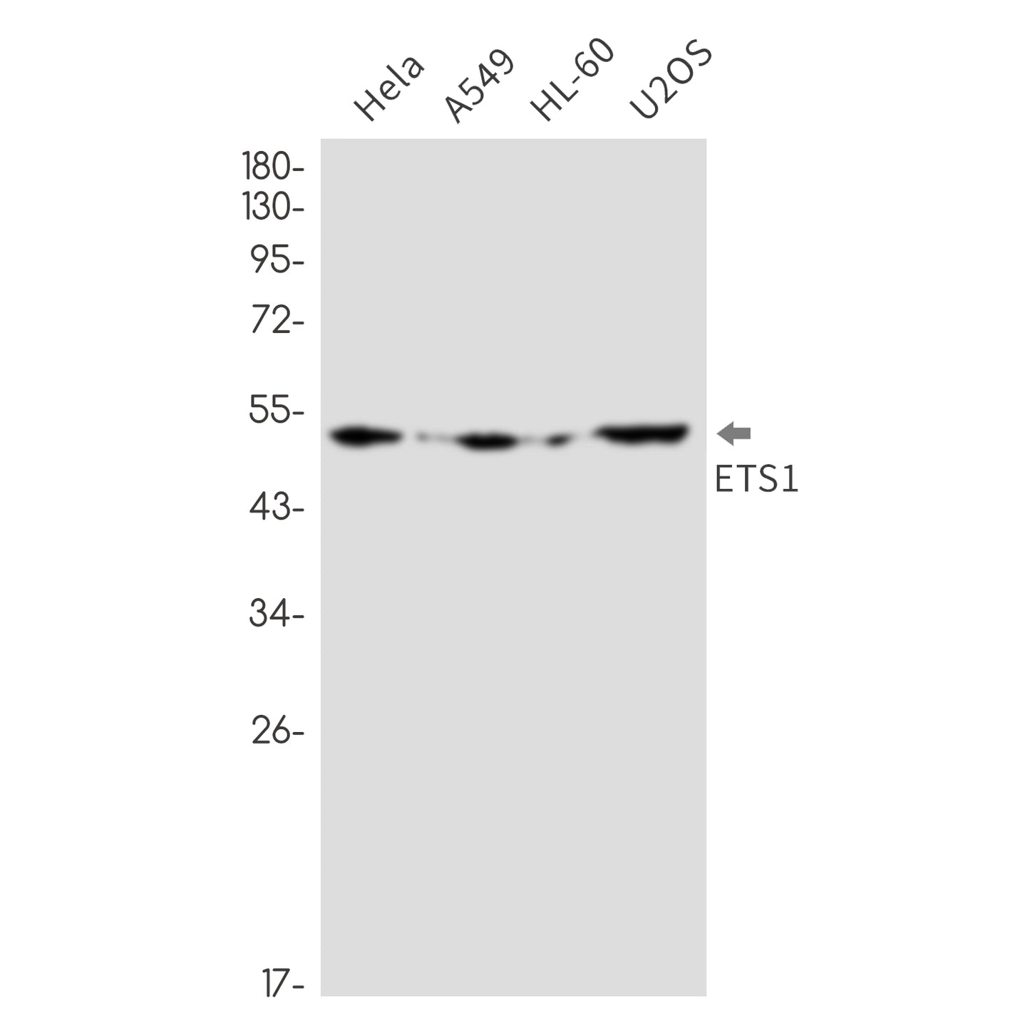 ETS1 Rabbit Monoclonal Antibody