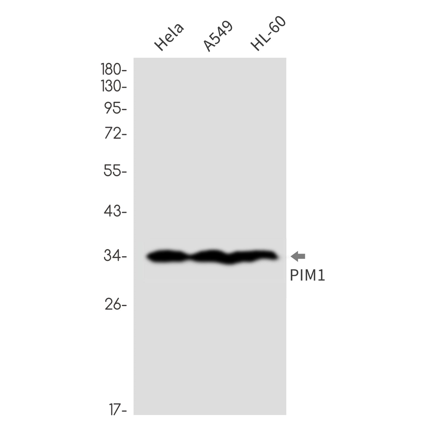 PIM1 Rabbit Monoclonal Antibody