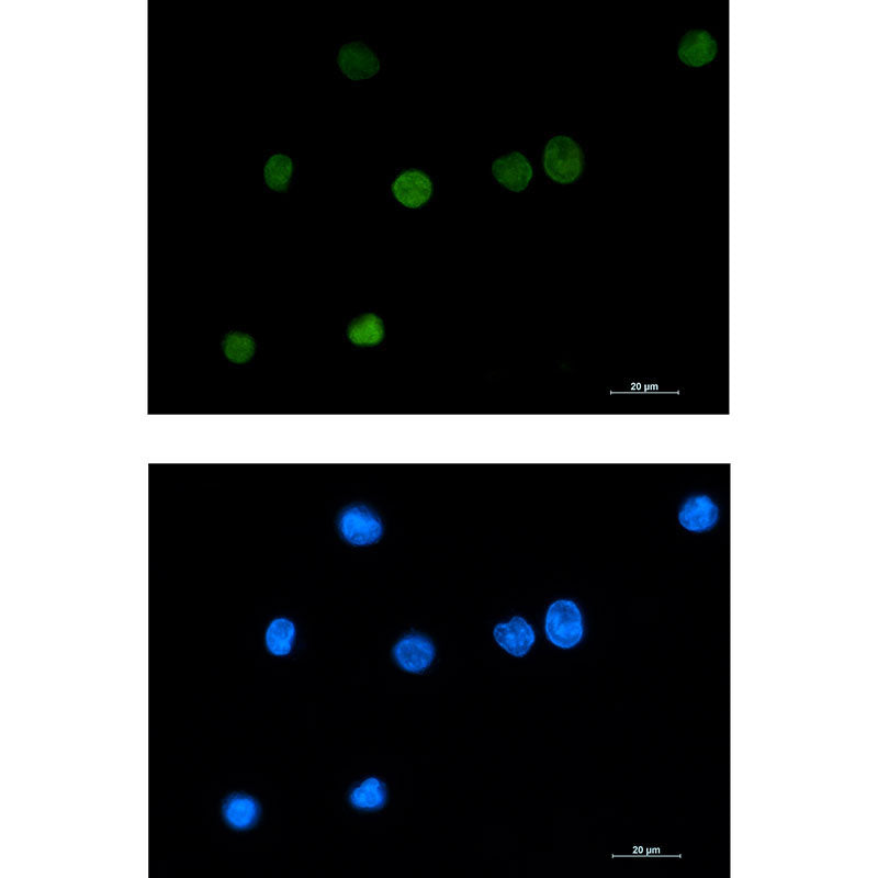 Histone H1.2 Rabbit Monoclonal Antibody