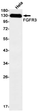 FGFR3 Rabbit Monoclonal Antibody