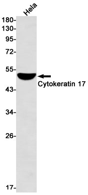 Cytokeratin 17 Rabbit Monoclonal Antibody