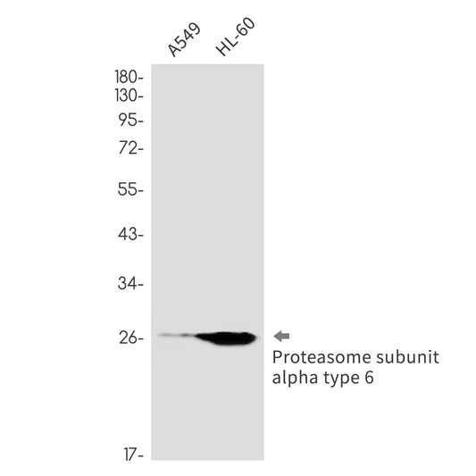 Proteasome alpha 6 Rabbit Monoclonal Antibody