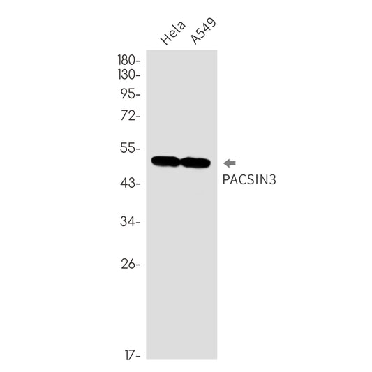 PACSIN3 Rabbit Monoclonal Antibody