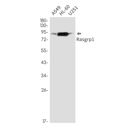 RASGRP1 Rabbit Monoclonal Antibody
