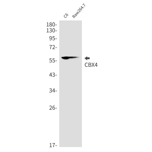 CBX4 Rabbit Monoclonal Antibody