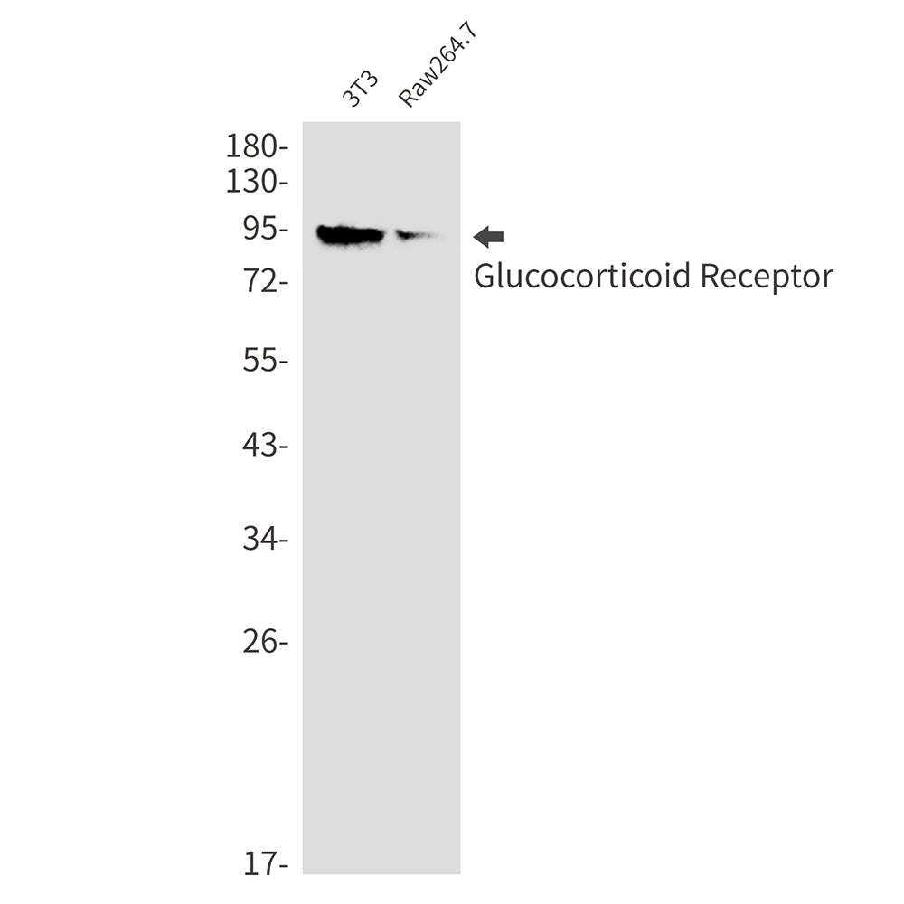Glucocorticoid Receptor Rabbit Monoclonal Antibody