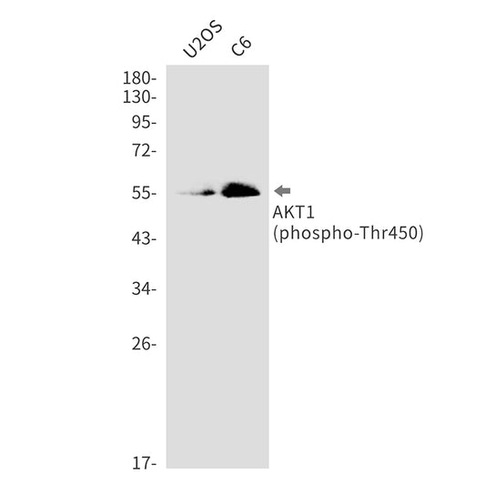 Phospho-AKT1 (Thr450) Rabbit Monoclonal Antibody