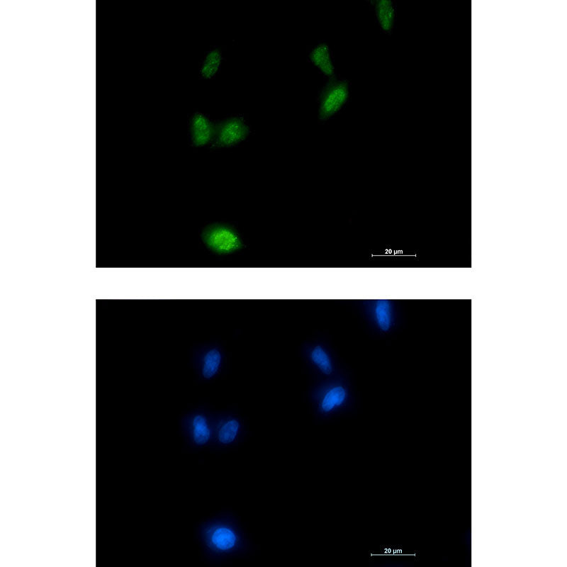 Phospho-Amyloid Precursor Protein (Thr743) Rabbit Monoclonal Antibody