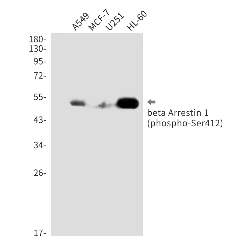 Phospho-beta Arrestin 1 (Ser412) Rabbit Monoclonal Antibody