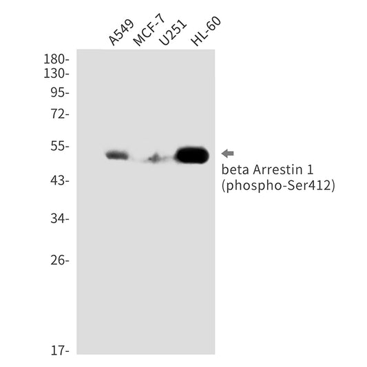 Phospho-beta Arrestin 1 (Ser412) Rabbit Monoclonal Antibody