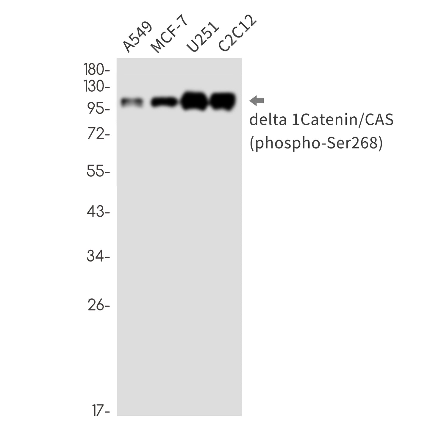 Phospho-delta 1 Catenin (Ser268) Rabbit Monoclonal Antibody