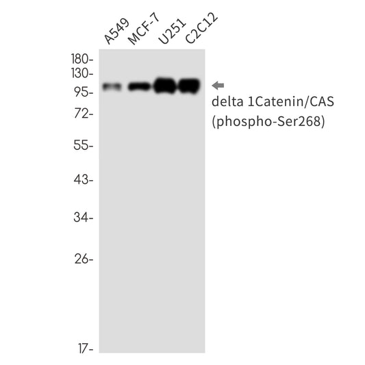 Phospho-delta 1 Catenin (Ser268) Rabbit Monoclonal Antibody