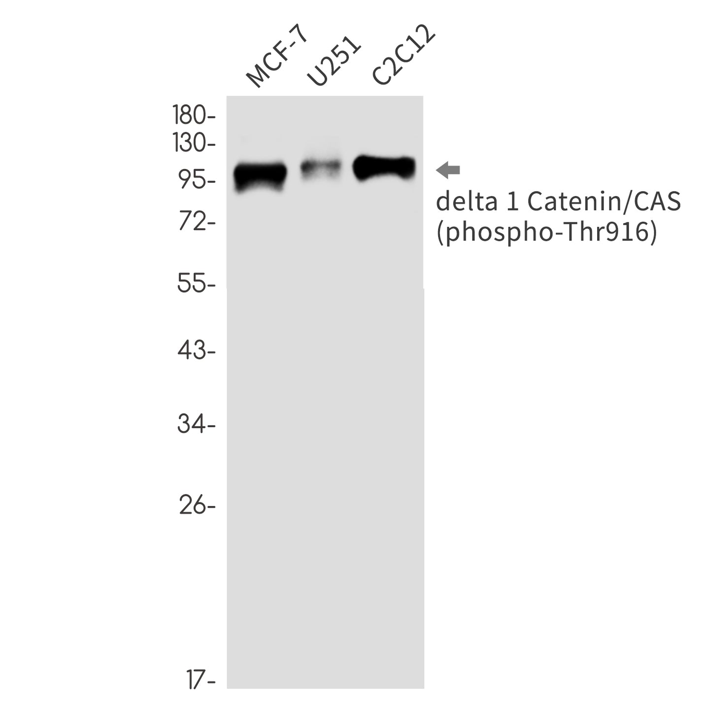 Phospho-delta 1 Catenin (Thr916) Rabbit Monoclonal Antibody