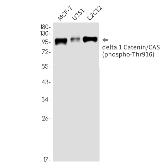 Phospho-delta 1 Catenin (Thr916) Rabbit Monoclonal Antibody