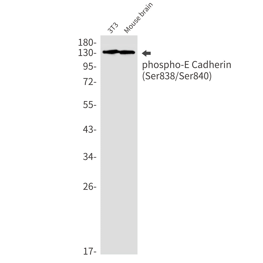 Phospho-E Cadherin (Ser838/Ser840) Rabbit Monoclonal Antibody