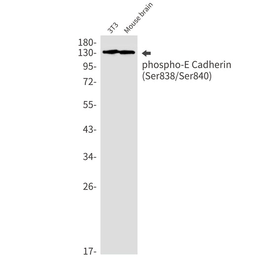 Phospho-E Cadherin (Ser838/Ser840) Rabbit Monoclonal Antibody