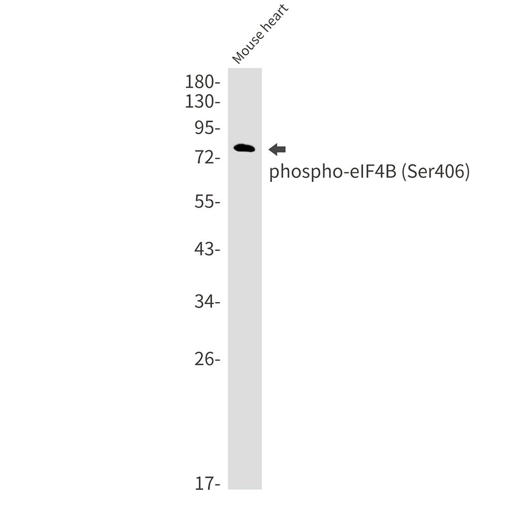 Phospho-eIF4B (Ser406) Rabbit Monoclonal Antibody